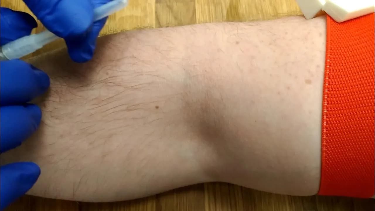 Jak podłączyć kroplówkę – bezpieczna instrukcja krok po kroku z ostrzeżeniami